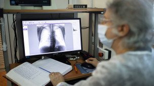 Врач-рентгенолог изучает результат флюорографии легких