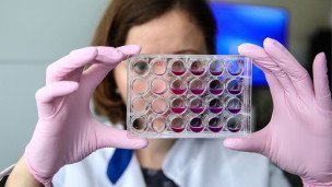 Planshet-s-biomaterialom-dlya-skrininga-v-Biomeditsinskom-nauchno-tekhnologicheskom-parke