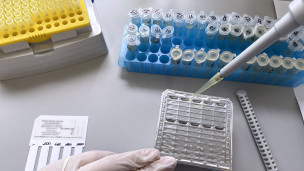 Тест-система для выявления случаев заражения оспой обезьян