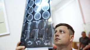 Врач изучает рентгеновский снимок в травматологическом центре