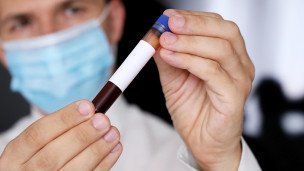 medicinskij-sotrudnik-s-probirkoj-v-rukah