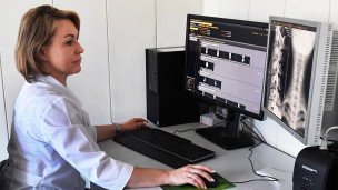 Врач-рентгенолог смотрит снимки пациента 