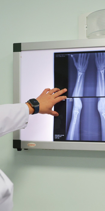 Врачи-травматологи осматривают рентгеновский снимок 